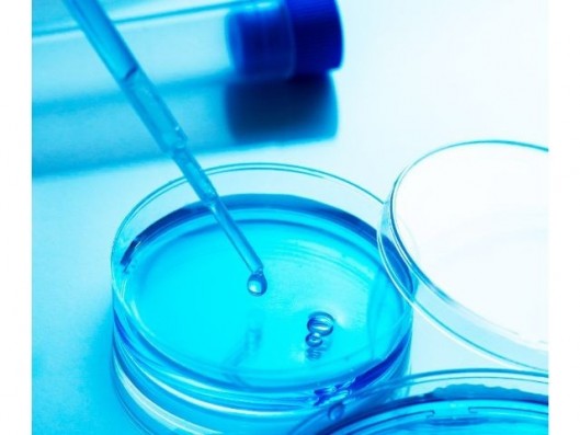 ANÁLISIS DE LEGIONELLA EN...