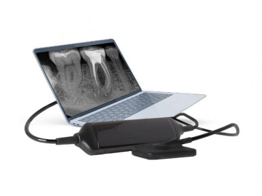 SENSOR DIGITAL DE RAYOS X...