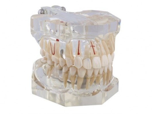 MACROMODELO CON PATOLOGÍA...