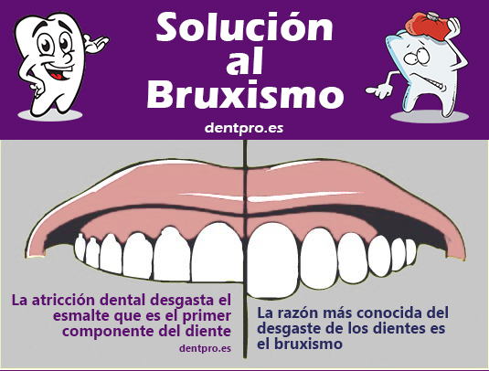 Bruxismo Dental