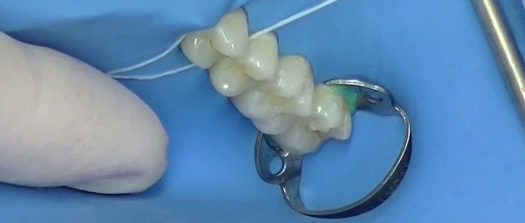 clamps-dentales