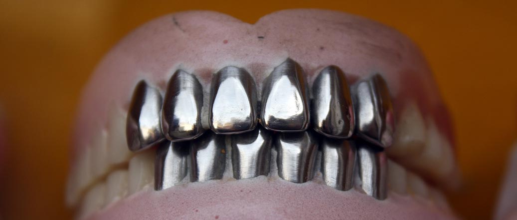 material prótesis dental